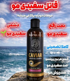 شامپو ضد ریزش ورفع سفیدی مو با عصاره خاویار اکسونیک دارای ویتامین b5 قویترین رطوبت رسان مو حجم 300 میل
