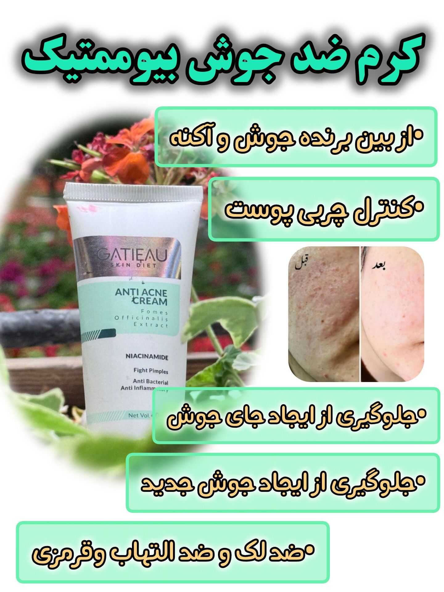 قویترین کرم ژلی ضد جوش و ضد لک برند گاتیو اصل ایتالیا رفع جای جوش/ابرسان/ضد لک مستقیم از نمایندگی حجم 40 میل